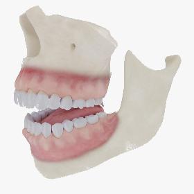 3D Teeth, gums and bones model